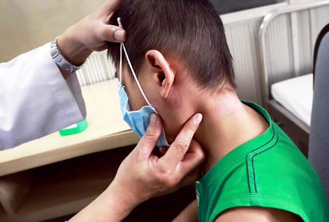 ​Bệnh nh&acirc;n mắc bệnh vi khuẩn ăn thịt người tại miền Trung tăng đột biến - Ảnh 1.