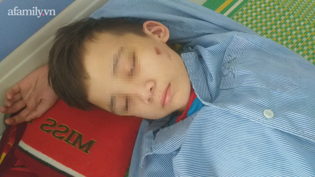 Vụ bé trai 14 tuổi bị chủ quán bánh xèo ở Bắc Ninh tra tấn: Nhà trường sẵn sàng cho cháu trở lại học - Ảnh 1.