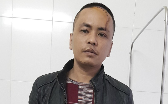 Bắc Ninh: Nam thanh niên chém bố đẻ và 2 công an xã rồi quát thuốc của tao đâu - Ảnh 1.