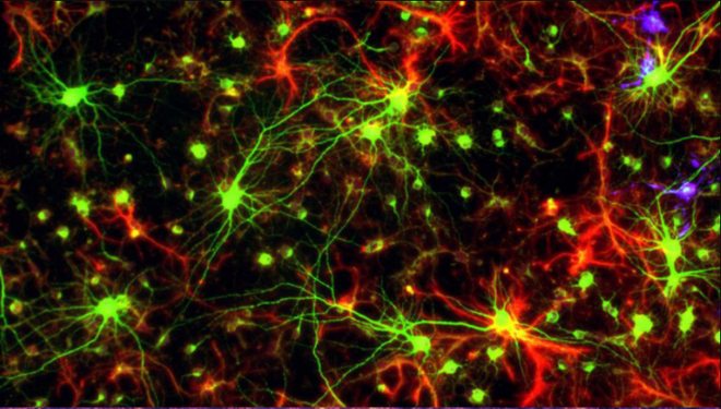 Các nhà khoa học kinh ngạc khi phát hiện sự tương đồng kỳ lạ giữa não người và vũ trụ - Ảnh 2.