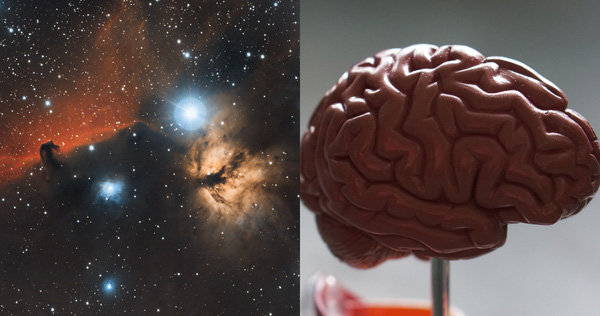 Các nhà khoa học kinh ngạc khi phát hiện sự tương đồng kỳ lạ giữa não người và vũ trụ - Ảnh 1.