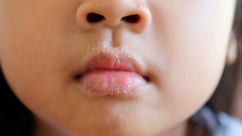Gan mà rối loạn thì miệng sẽ xảy ra 4 vấn đề, xem thử bạn có đang gặp triệu chứng nào không - Ảnh 4.