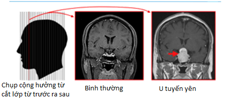 Cô gái chưa chồng và chưa sinh con đột nhiên thấy ngực tiết chất lỏng như sữa, nghe bác sĩ nói nguyên nhân mà càng rụng rời - Ảnh 2.