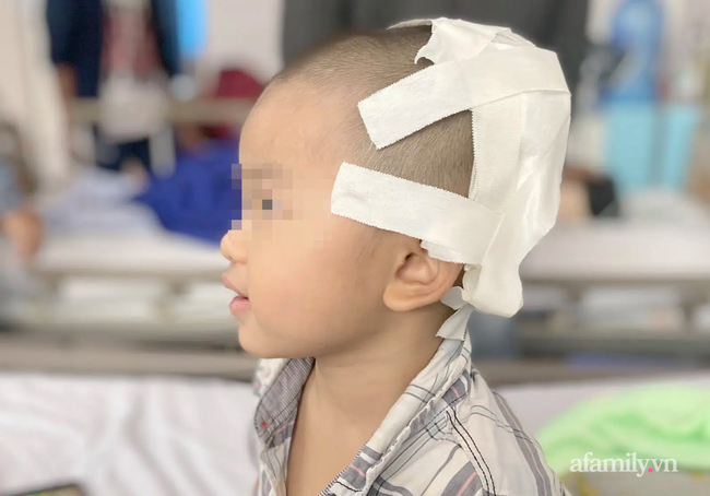 Tai nạn kinh hoàng: Anh lấy xe đạp chở em út quanh xóm rồi bị té, bé trai 2 tuổi lõm sọ não - Ảnh 1.