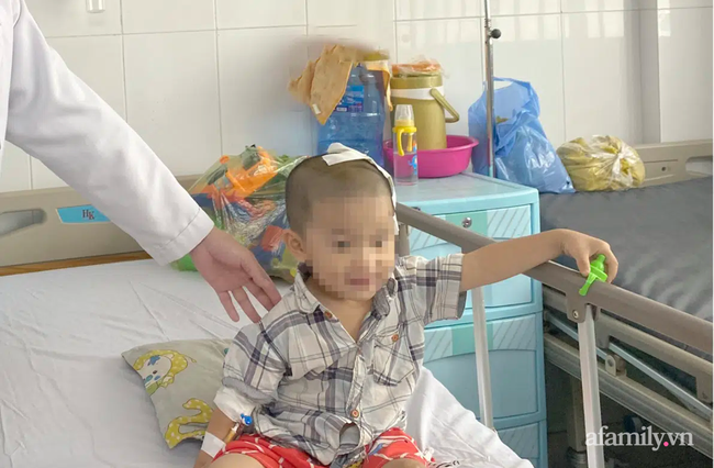 Tai nạn kinh hoàng: Anh lấy xe đạp chở em út quanh xóm rồi bị té, bé trai 2 tuổi lõm sọ não - Ảnh 3.