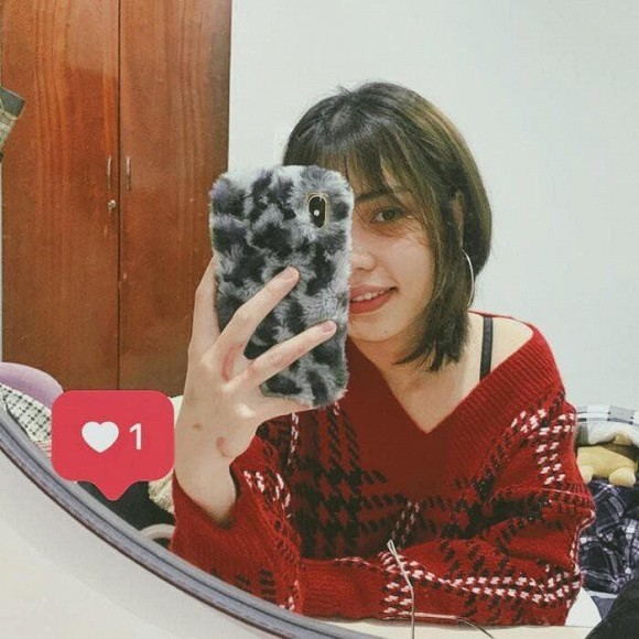 Cô gái bị chồng sắp cưới tạt axit hủy hoại nửa khuôn mặt và hành trình đau đớn để phục hồi nhan sắc ngoạn mục - Ảnh 3. Cô gái bị chồng sắp cưới tạt axit hủy hoại nửa khuôn mặt và hành trình đau đớn để phục hồi nhan sắc ngoạn mục - Ảnh 3.