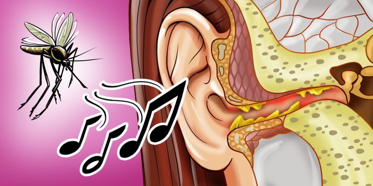 H&oacute;a ra đ&acirc;y l&agrave; l&yacute; do tại sao muỗi lu&ocirc;n vo ve ở b&ecirc;n tai ch&uacute;ng ta v&agrave; c&aacute;ch cực đơn giản để giải quyết sự kh&oacute; chịu n&agrave;y - Ảnh 2.