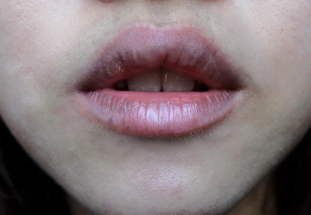 Con gái mắc bệnh phụ khoa thường có 3 triệu chứng nổi quanh miệng, số 2 nhiều người dễ gặp phải - Ảnh 2.