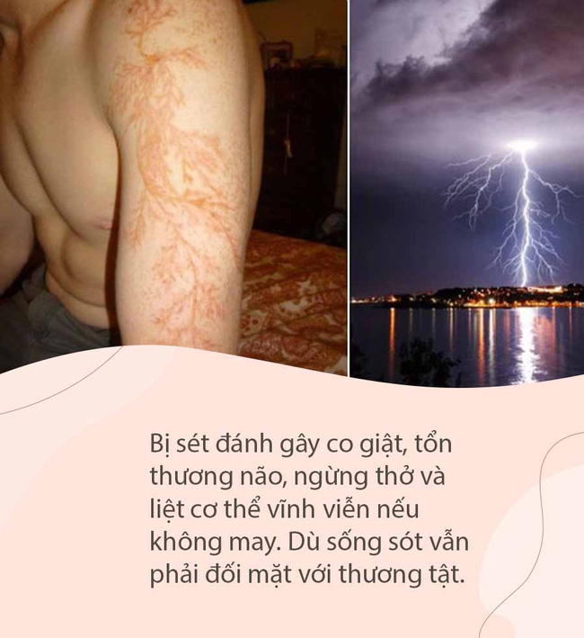 Kỳ lạ người đàn ông bị sét đánh 7 lần liên tục, cơ thể tổn thương từ bên ngoài đến nội tạng vẫn không chết, được người ta mệnh danh là vua lỳ đòn - Ảnh 6.