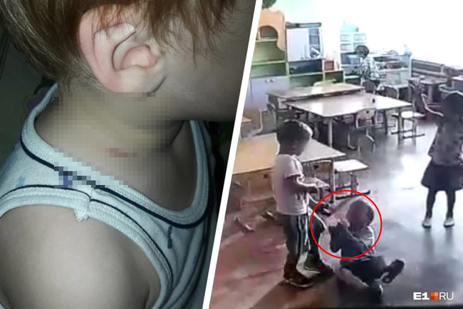 Mẹ đón con từ trường về với vết thâm tím trên cổ, bủn rủn tay chân khi xem lại camera nhưng giận run người với câu trả lời của giáo viên - Ảnh 2.