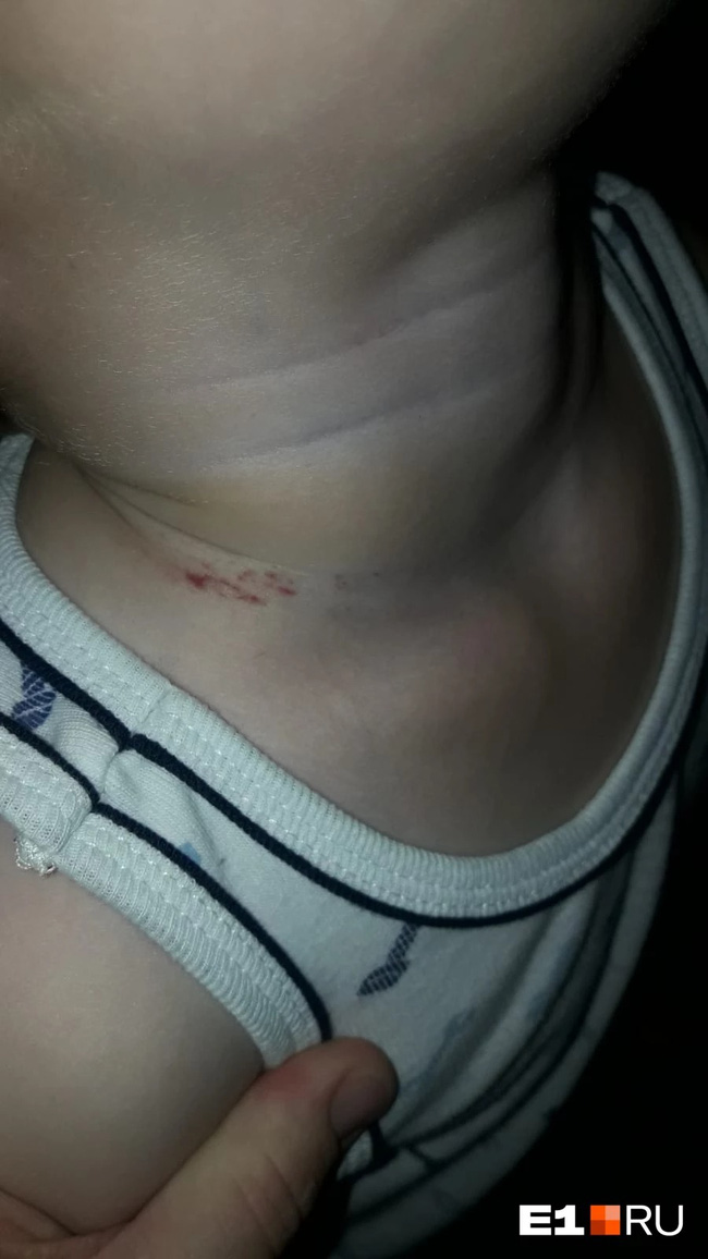 Mẹ đón con từ trường về với vết thâm tím trên cổ, bủn rủn tay chân khi xem lại camera nhưng giận run người với câu trả lời của giáo viên - Ảnh 3.