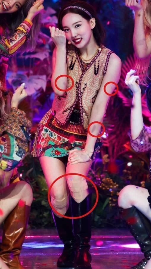 1 vũ đạo của TWICE kh&oacute; đến mức nhảy xong l&agrave; chẳng đi nổi, vậy m&agrave; Jeongyeon vỡ đĩa đệm cổ vẫn biểu diễn ngon l&agrave;nh - Ảnh 10.