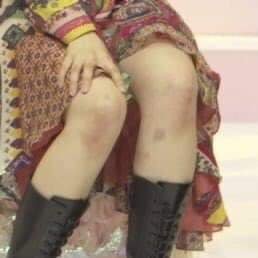 1 vũ đạo của TWICE kh&oacute; đến mức nhảy xong l&agrave; chẳng đi nổi, vậy m&agrave; Jeongyeon vỡ đĩa đệm cổ vẫn biểu diễn ngon l&agrave;nh - Ảnh 12.