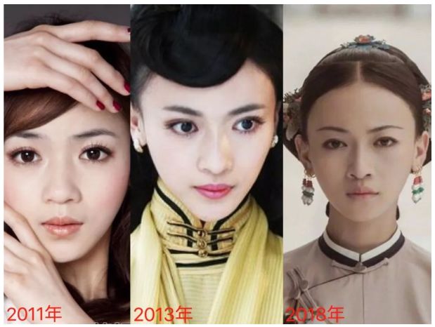 Ngô Cẩn Ngôn: Ngụy Anh Lạc chảnh choẹ dính 1001 phốt thẩm mỹ, ké fame Angela Baby giờ ra sao khi Diên Hi Công Lược hết hot? - Ảnh 8. Ngô Cẩn Ngôn: Ngụy Anh Lạc chảnh choẹ dính 1001 phốt thẩm mỹ, ké fame Angela Baby giờ ra sao khi Diên Hi Công Lược hết hot? - Ảnh 8.