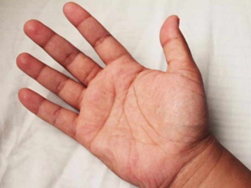 3 đặc điểm thường gặp trên bàn tay là dấu hiệu của người có thận khỏe, mong rằng bạn có đủ cả 3 - Ảnh 2.