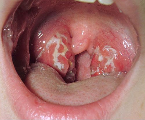 5 loại ung thư có khuynh hướng di truyền rất cao, nhà có tiền sử người mắc bệnh nên chủ động đi tầm soát ngay - Ảnh 4.