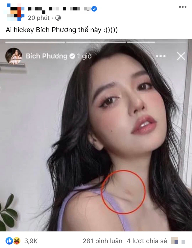 Bích Phương trượt tay để lộ dấu vết lạ trên cổ, netizen tranh cãi liệu có phải hickey? - Ảnh 3.