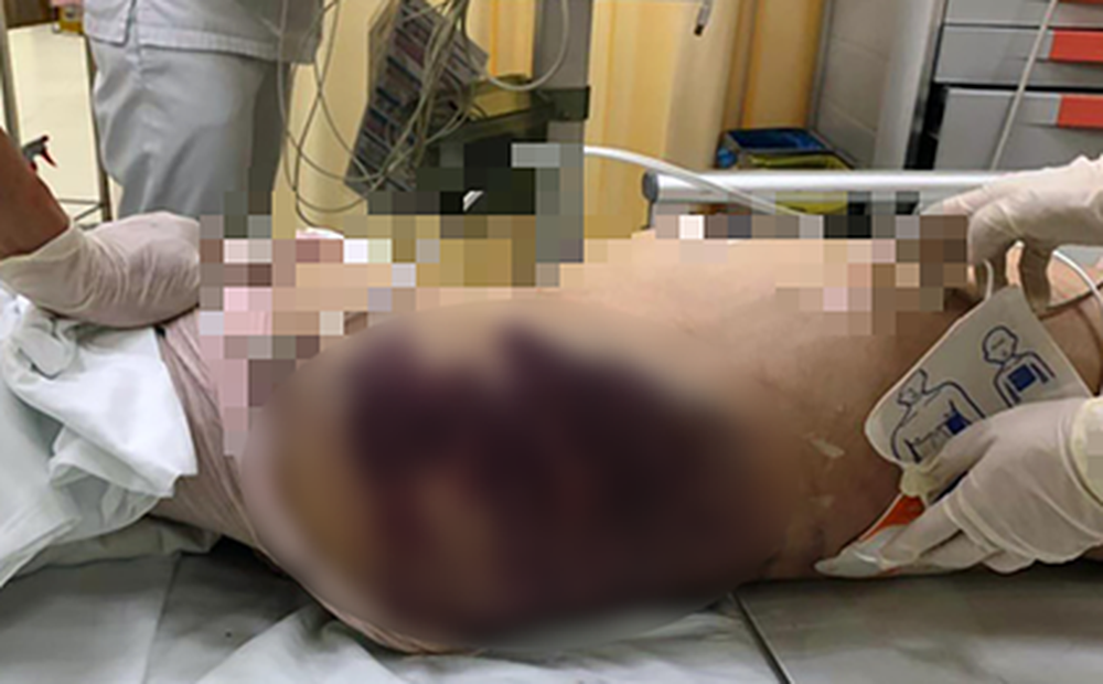 Bé 8 tuổi tử vong nghi do dì ghẻ bạo hành, mẹ ruột đau xót: Cả năm không được gặp con - Ảnh 1. Bé 8 tuổi tử vong nghi do dì ghẻ bạo hành, mẹ ruột đau xót: Cả năm không được gặp con - Ảnh 1.