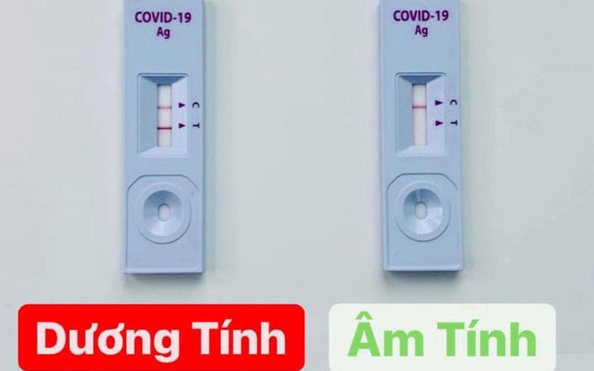 Test nhanh vạch T đậm hay mờ có thể hiện Covid-19 nặng hay nhẹ? - Ảnh 1.