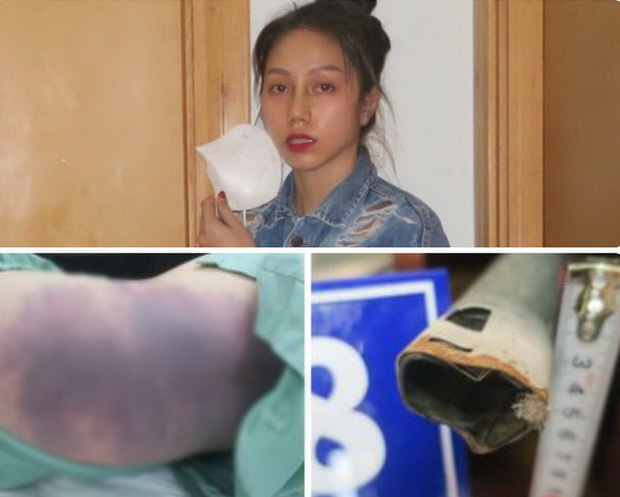 Hiệu trưởng trường bé gái 8 tuổi bị dì ghẻ bạo hành: Bé là đứa trẻ ngoan, nhà trường tìm đến tận nhà mới biết em đã qua đời - Ảnh 2. Hiệu trưởng trường bé gái 8 tuổi bị dì ghẻ bạo hành: Bé là đứa trẻ ngoan, nhà trường tìm đến tận nhà mới biết em đã qua đời - Ảnh 2.