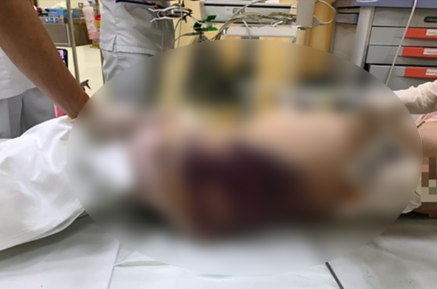 Vụ d&igrave; ghẻ h&agrave;nh hạ b&eacute; g&aacute;i 8 tuổi tử vong: Ph&acirc;n t&iacute;ch n&oacute;ng của TS Lưu B&igrave;nh Nhưỡng - Ảnh 2.