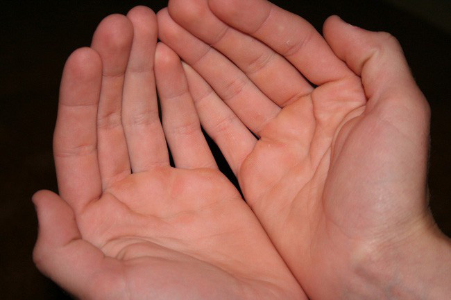 5 tín hiệu trên đôi bàn tay ngầm cảnh báo tế bào ung thư gan đã gõ cửa, cần chủ động kiểm tra ngay - Ảnh 3.