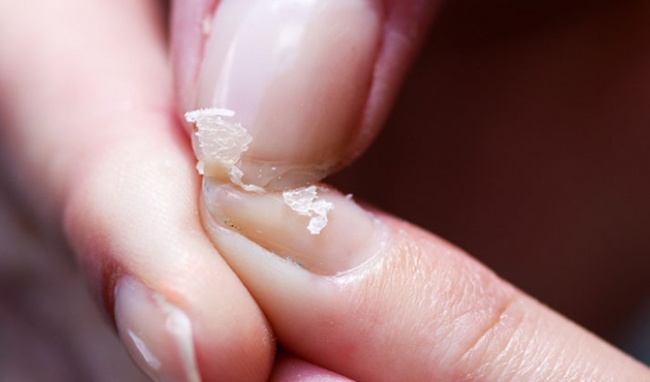 5 tín hiệu trên đôi bàn tay ngầm cảnh báo tế bào ung thư gan đã gõ cửa, cần chủ động kiểm tra ngay - Ảnh 5.