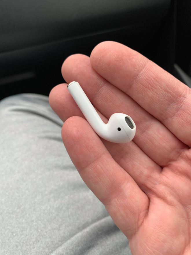 Đeo tai nghe lúc ngủ, anh thanh niên vô tình nuốt luôn 1 bên AirPods khiến nó kẹt cứng ở thực quản - Ảnh 1.