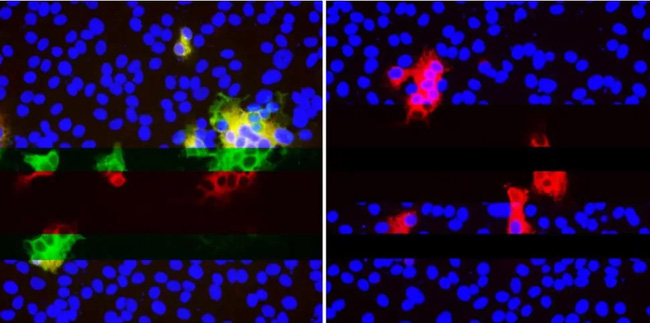 Virus SARS-CoV-2 đột biến đang lén lút qua mắt hệ miễn dịch bằng cách nào? - Ảnh 2.