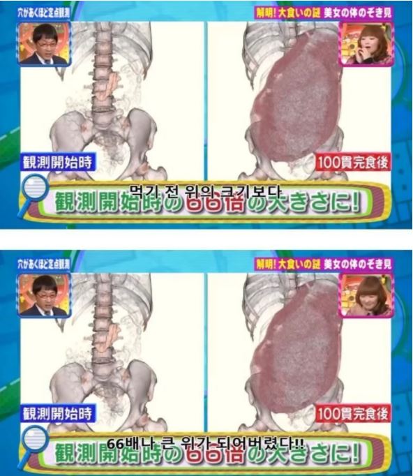 Ăn 100 miếng sushi cùng lúc, nữ YouTuber gây sốc khi công khai luôn ảnh chụp CT dạ dày, chứng minh mình không gian dối - Ảnh 3.