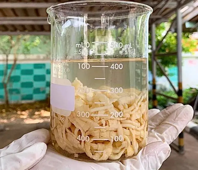 Ăn nhiều thịt bò sống, người đàn ông xì hơi ra sán dây dài 18m phá vỡ mọi kỷ lục - Ảnh 3. Ăn nhiều thịt bò sống, người đàn ông xì hơi ra sán dây dài 18m phá vỡ mọi kỷ lục - Ảnh 3.