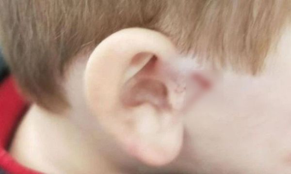 Bé trai 4 tuổi bị thương tổn nặng ở tai vì đồ vật này trong siêu thị, bất kỳ cửa hàng quần áo nào cũng có - Ảnh 1.