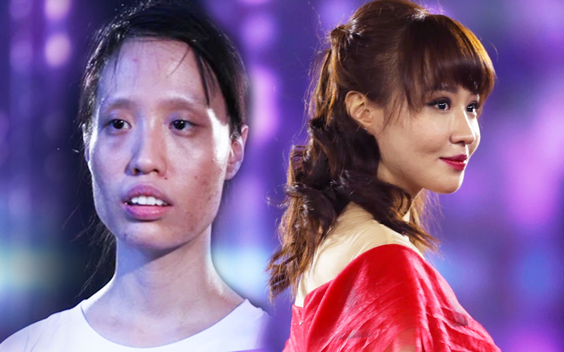 Sau 10 cuộc phẫu thuật cam go, cô gái trẻ bị gọi là “quái vật” trở nên xinh đẹp ngọt ngào như gái Hàn