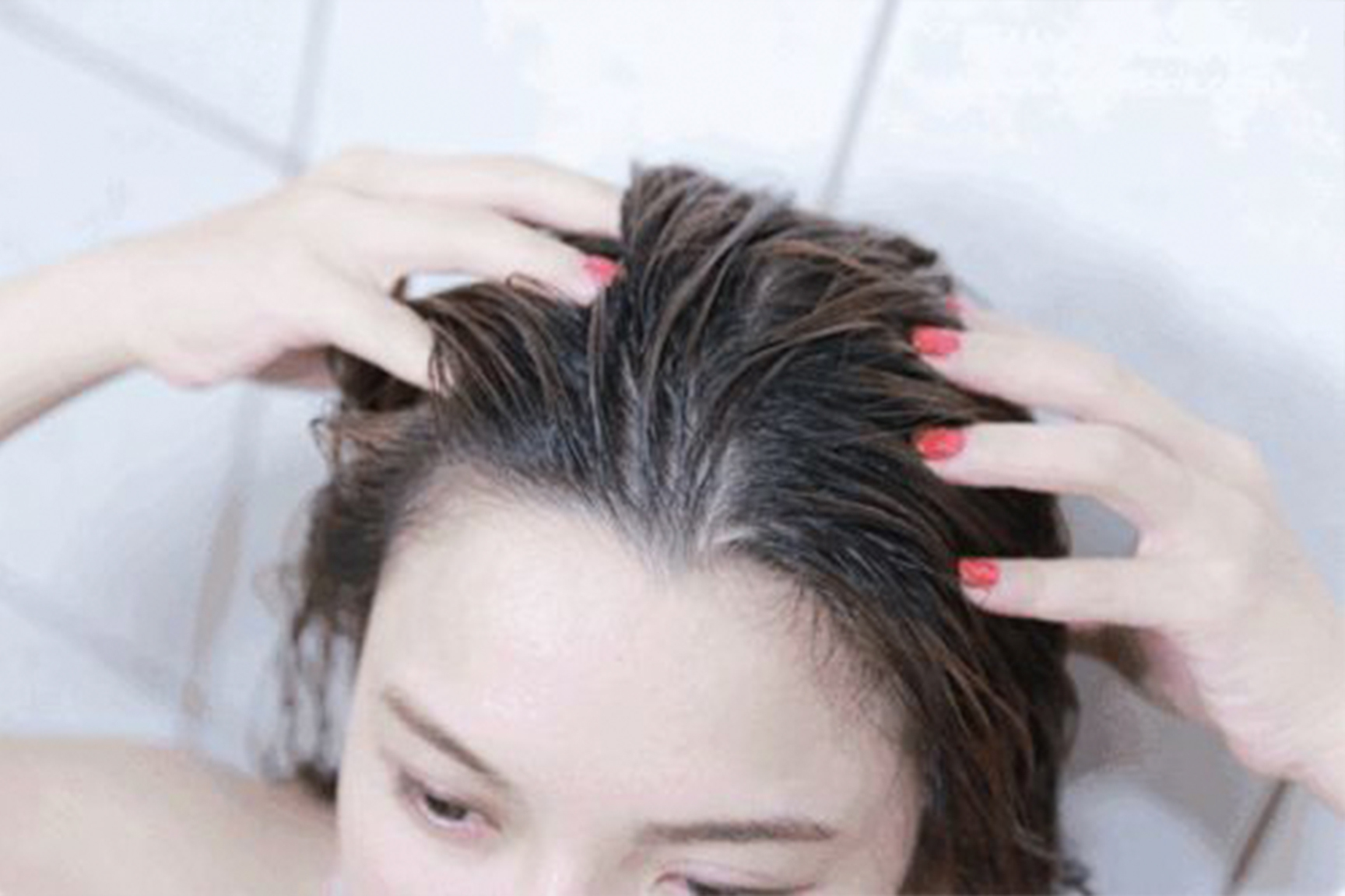 Ngày nào cũng gội đầu sạch sẽ mà vẫn mọc mụn da đầu: 4 nguyên nhân thường gặp hoặc 3 căn bệnh nguy hiểm có thể bạn đã mắc phải - Ảnh 1.