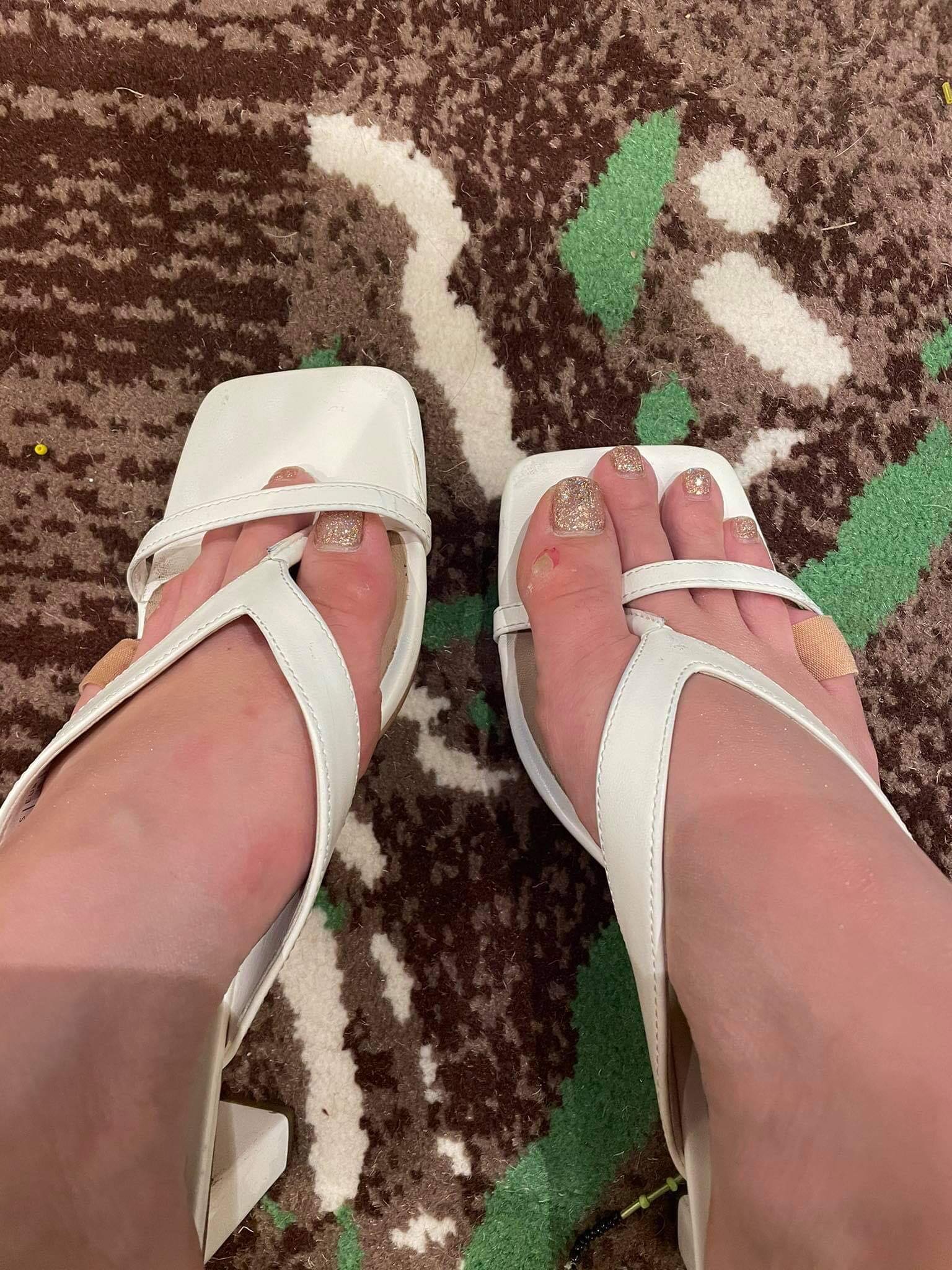 Kh&aacute;nh V&acirc;n tiết lộ về chấn thương ở ch&acirc;n: Đứng trong c&aacute;nh g&agrave; rất l&agrave; đau nhưng bước ra s&acirc;n khấu th&igrave; qu&ecirc;n hết - Ảnh 6.