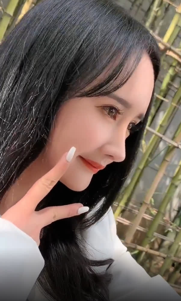 Nở rộ trào lưu phẫu thuật thẩm mỹ mũi và mép tóc giống Dương Mịch, dàn hotgirl xứ Trung giờ ai cũng như ai - Ảnh 7. Nở rộ trào lưu phẫu thuật thẩm mỹ mũi và mép tóc giống Dương Mịch, dàn hotgirl xứ Trung giờ ai cũng như ai - Ảnh 7.