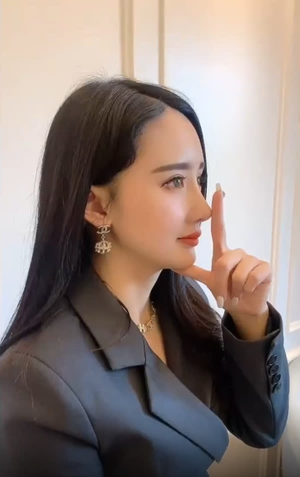 Nở rộ trào lưu phẫu thuật thẩm mỹ mũi và mép tóc giống Dương Mịch, dàn hotgirl xứ Trung giờ ai cũng như ai - Ảnh 15. Nở rộ trào lưu phẫu thuật thẩm mỹ mũi và mép tóc giống Dương Mịch, dàn hotgirl xứ Trung giờ ai cũng như ai - Ảnh 15.