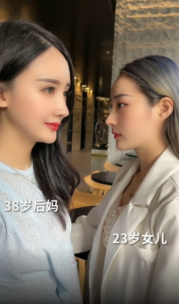 Nở rộ trào lưu phẫu thuật thẩm mỹ mũi và mép tóc giống Dương Mịch, dàn hotgirl xứ Trung giờ ai cũng như ai - Ảnh 13. Nở rộ trào lưu phẫu thuật thẩm mỹ mũi và mép tóc giống Dương Mịch, dàn hotgirl xứ Trung giờ ai cũng như ai - Ảnh 13.