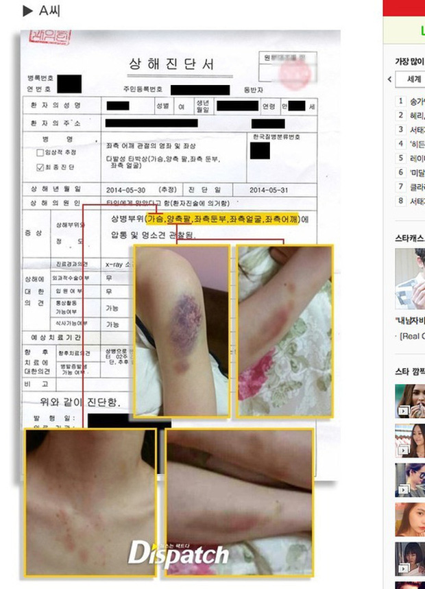 Bóc trần Kim Hyun Joong: Nam thần Vườn Sao Băng đè bẹp Lee Min Ho, tuột dốc sau 1 đêm vì bê bối đánh bạn gái gãy xương sườn - Ảnh 11.