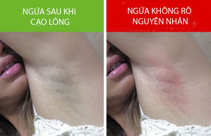 6 dấu hiệu cho thấy nách đang cố cảnh báo những vấn đề sức khỏe tưởng bình thường nhưng hóa ra lại bất thường - Ảnh 2.