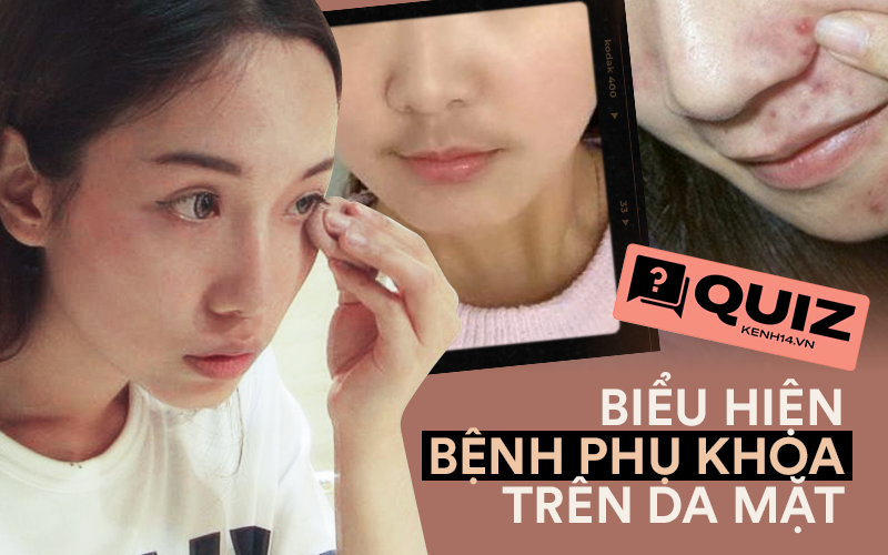 Quiz: Phụ nữ mắc bệnh phụ khoa thường có 4 biểu hiện trên khuôn mặt, nếu bạn không có thì xin chúc mừng - Ảnh 1.