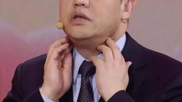3 hình dạng bất thường của lưỡi cho thấy có thể bệnh tuyến giáp đang âm thầm phát triển trong cơ thể, cần đi khám ngay - Ảnh 2.