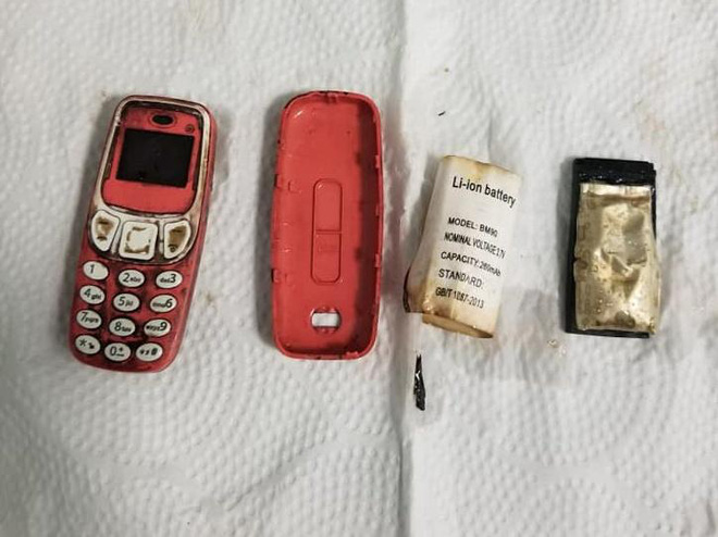 Sợ bị phát hiện, tù nhân nuốt luôn... Nokia 3310 vào bụng - Ảnh 1.