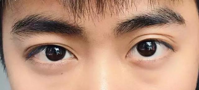 Bất kể nam hay nữ, lông mọc ở 3 vị trí trên cơ thể càng dày thì tuổi thọ càng cao, nhiều người không biết lại cảm thấy xấu hổ, tự ti về nó - Ảnh 1.
