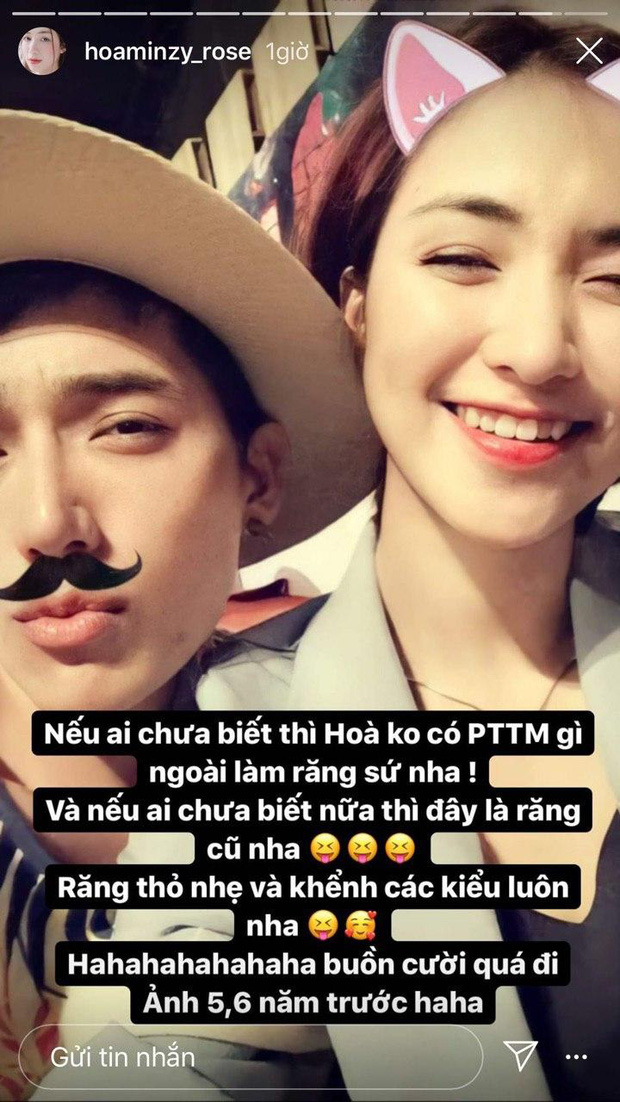 Rộ tin Hoà Minzy dao kéo 1 điểm trên gương mặt, chính chủ phản ứng thế nào? - Ảnh 4.