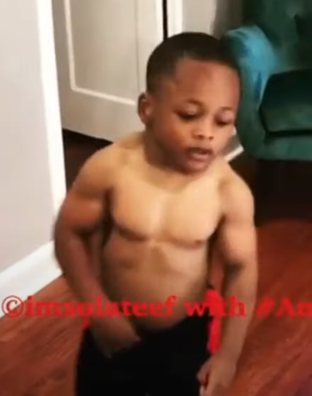 Cậu bé 8 tuổi biệt danh Hulk con có body cuồn cuộn cơ bắp vì mắc phải bệnh hiếm - Ảnh 3.