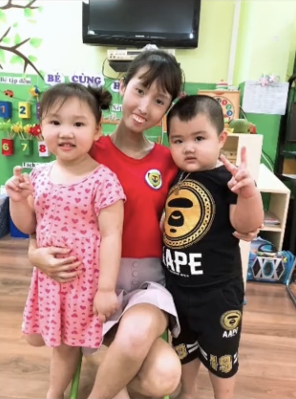 C&ocirc; gi&aacute;o mầm non mắc bệnh hiếm khiến nhan sắc biến đổi: Clip 15 gi&acirc;y g&acirc;y b&atilde;o MXH - Ảnh 5.