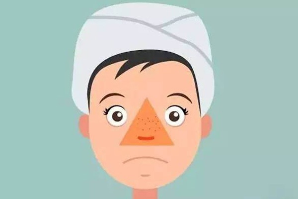 5 kiểu khuôn mặt có thể là cảnh báo sớm của bệnh tật hoặc ung thư - Ảnh 3.