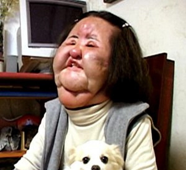 Thảm họa thẩm mỹ xứ Hàn: Nữ ca sĩ 17 lần phẫu thuật cứu vãn nhan sắc vì tự tiêm dầu ăn và cái chết bí ẩn tuổi 57 - Ảnh 7.