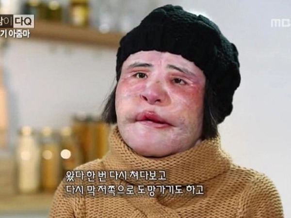 Thảm họa thẩm mỹ xứ Hàn: Nữ ca sĩ 17 lần phẫu thuật cứu vãn nhan sắc vì tự tiêm dầu ăn và cái chết bí ẩn tuổi 57 - Ảnh 6.